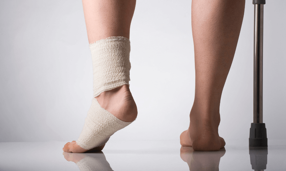 sprained ankle treatment